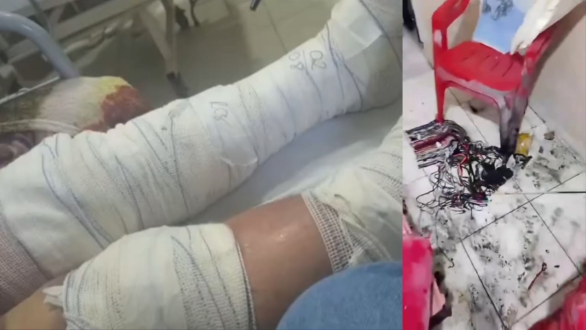 Idosa sofre queimaduras após balão com rojão atingir casa em Nova Iguaçu